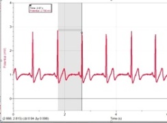 EKG heart rate